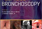 Flexible Bronchoscopy 4th Edition PDF