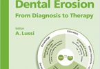 Dental Erosion From Diagnosis to Therapy PDF